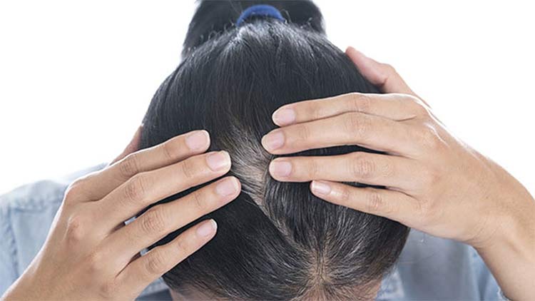 Cách trị tóc bạc sớm tại nhà hiệu quả cho cả nam và nữ giới
