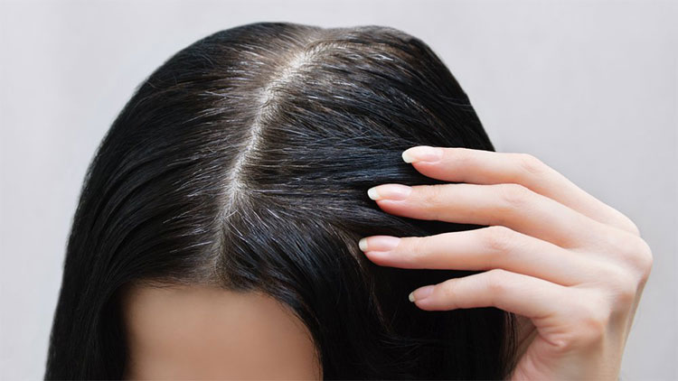 Cơ thể ngừng sản xuất sắc tố giải thích vì sao tóc bạn bạc thành màu trắng