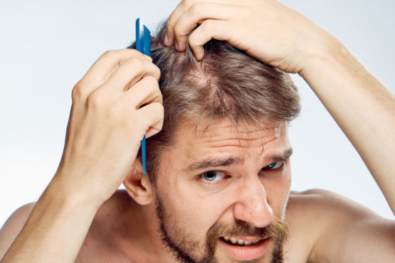 Phục hồi tóc nam hư tổn đơn giản mà hiệu quả, các chàng chú ý nhé!