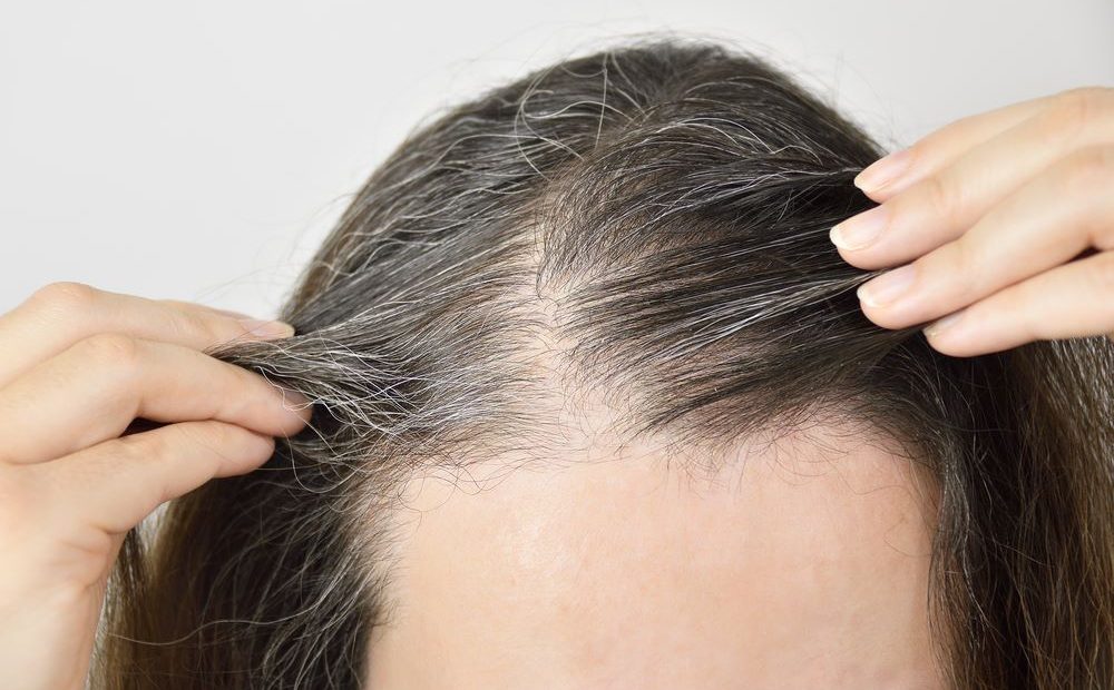 Những bài thuốc chữa tóc bạc, hỗ trợ tình trạng tóc bạc sớm 1