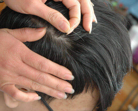 Tóc bạc sớm là thiếu chất gì Cách bổ sung khoa học giúp ngăn tóc bạc sớm