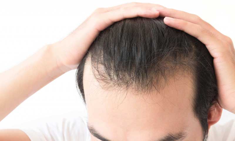 4 lời khuyên chăm sóc tóc giúp cải thiện mái tóc mỏng  ELLE Man