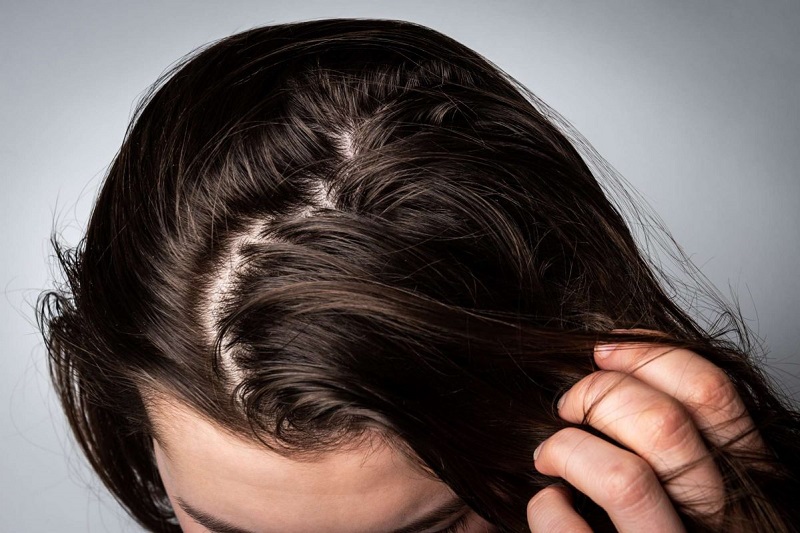Lưu ý khi chăm sóc tóc để hạn chế tình trạng bết dính 1